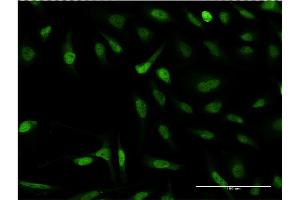 Immunofluorescence of monoclonal antibody to SNAPC4 on HeLa cell. (SNAPC4 antibody  (AA 53-162))
