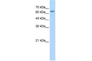 GUSB antibody used at 2. (Glucuronidase beta antibody  (C-Term))