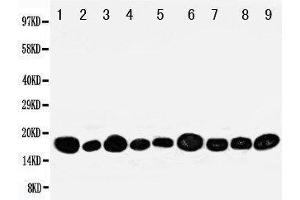 Western Blotting (WB) image for anti-Nucleoside diphosphate kinase B (NME2) (AA 137-152), (C-Term) antibody (ABIN3044198) (NME2 antibody  (C-Term))