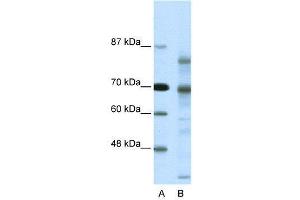 WB Suggested Anti-NCOR2  Antibody Titration: 0. (NCOR2 antibody  (N-Term))