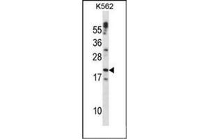 Western blot analysis of Cardiotrophin-1 Antibody (C-term) in K562 cell line lysates (35ug/lane).