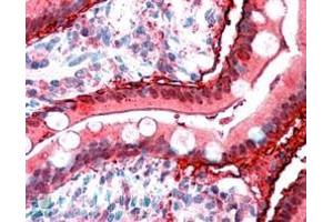 ABIN190807 (2. (FABP2 antibody  (C-Term))