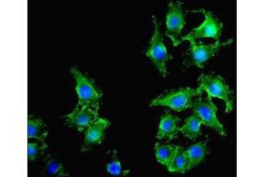 Immunofluorescence (IF) image for anti-Oxidized Low Density Lipoprotein (Lectin-Like) Receptor 1 (OLR1) (AA 58-273) antibody (ABIN7162378)