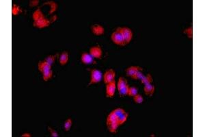Immunofluorescent analysis of MCF-7 cells using ABIN7164407 at dilution of 1:100 and Cy3-congugated Goat Anti-Rabbit IgG (LDHD antibody  (AA 310-507))