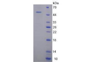 SDS-PAGE (SDS) image for Tenascin C (TNC) (AA 174-621) protein (His tag) (ABIN6238078) (TNC Protein (AA 174-621) (His tag))