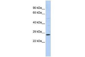 WB Suggested Anti-RAB38 Antibody Titration:  0.