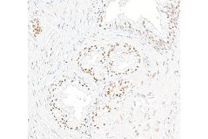 anti-Thyroid Hormone Receptor Associated Protein 3 (THRAP3) (C-Term) antibody