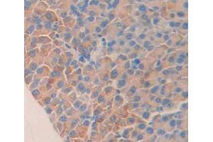 Used in DAB staining on fromalin fixed paraffin- embedded Kidney tissue (STAT1 antibody  (AA 432-680))