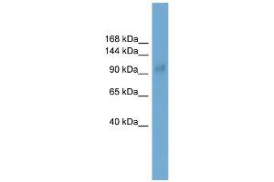 WB Suggested Anti-Lbxcor1 Antibody Titration:  0. (SKOR1 antibody  (Middle Region))