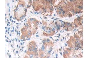 DAB staining on IHC-P; Samples: Human Stomach Tissue (LIPF antibody  (AA 20-398))