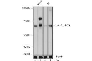 Western blot analysis of extracts of various cell lines, using Phospho--S473 mAb (ABIN6135179, ABIN6135970, ABIN6135971 and ABIN7101880) at 1:1000 dilution. (AKT1 antibody  (pSer473))