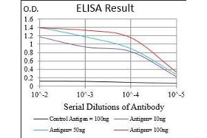 Black line: Control Antigen (100 ng), Purple line: Antigen(10 ng), Blue line: Antigen (50 ng), Red line: Antigen (100 ng), (CDX2 antibody  (AA 176-303))