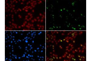 Immunofluorescence analysis of GFP-RNF168 trangenic U2OS cell using SUMO1 antibody. (SUMO1 antibody  (AA 1-101))