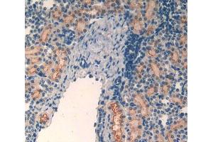 Used in DAB staining on fromalin fixed paraffin- embedded kidney tissue (MT2 antibody  (AA 1-61))