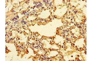 Immunohistochemistry of paraffin-embedded human lung tissue using ABIN7156249 at dilution of 1:100 (ING3 antibody  (AA 51-223))