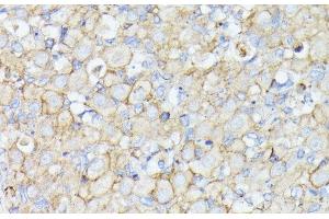 Immunohistochemistry of paraffin-embedded Rat ovary using MADCAM1 Polyclonal Antibody at dilution of 1:100 (40x lens). (MADCAM1 antibody)