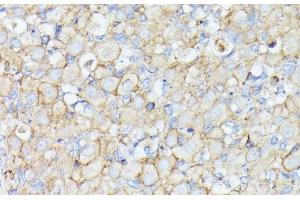 Immunohistochemistry of paraffin-embedded Rat ovary using MADCAM1 Polyclonal Antibody at dilution of 1:100 (40x lens).