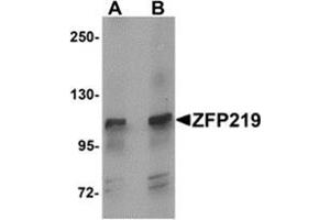 Western blot analysis of ZFP219 in mouse brain tissue lysate with ZFP219 antibody at (A) 1 and (B) 2 μg/ml.