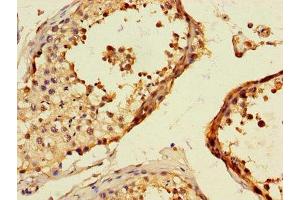 Immunohistochemistry of paraffin-embedded human testis tissue using ABIN7172291 at dilution of 1:100 (TLL1 antibody  (AA 522-643))