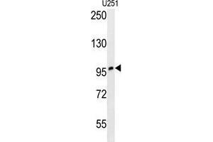 ZNF197 Antibody (N-term) western blot analysis in U251 cell line lysates (35 µg/lane).