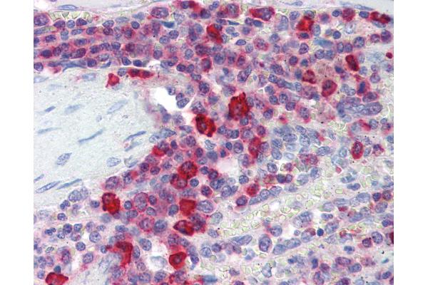 PIM3 antibody  (AA 259-288)