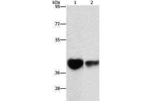 Western Blot analysis of Mouse brain tissue and NIH/3T3 cell using IDH3G Polyclonal Antibody at dilution of 1:350 (IDH3G antibody)