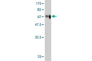 Western Blot detection against Immunogen (74. (SOCS4 antibody  (AA 1-440))