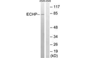 Western blot analysis of extracts from A549 cells, using EHHADH Antibody. (EHHADH antibody  (AA 476-525))