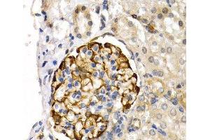 Immunohistochemistry of paraffin-embedded Rat kidney using LIPG Polyclonal Antibody at dilution of 1:200 (40x lens). (LIPG antibody)