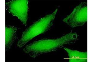 Immunofluorescence of purified MaxPab antibody to PSMD10 on HeLa cell. (PSMD10 antibody  (AA 1-226))