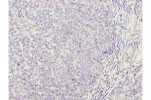 Immunohistochemistry of paraffin-embedded human tonsil tissue using ABIN7171361 at dilution of 1:100 (TRIM antibody  (AA 29-186))