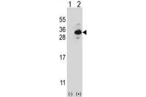 Western blot analysis of CLTB (arrow) using rabbit polyclonal CLTB Antibody .