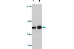 Western blot analysis of rat kidney tissue with ANAPC7 polyclonal antibody  at (Lane 1) 1 and (Lane 2) 2 ug/mL dilution. (ANAPC7 antibody  (C-Term))