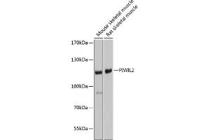Western blot analysis of extracts of various cell lines, using PIWIL2 antibody (ABIN6132495, ABIN6145700, ABIN6145701 and ABIN6221680) at 1:1000 dilution. (PIWIL2 antibody)