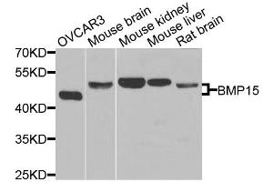 Western blot analysis of extracts of various cell lines, using BMP15 antibody (ABIN5975746) at 1/1000 dilution.