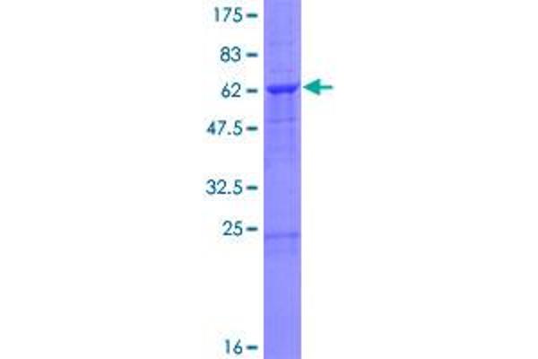 UFD1L Protein (AA 1-307) (GST tag)