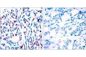 Image no. 1 for anti-Signal Transducer and Activator of Transcription 3 (Acute-Phase Response Factor) (STAT3) (pTyr705) antibody (ABIN2888531) (STAT3 antibody  (pTyr705))