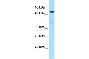 Host: Rabbit Target Name: PTCD1 Sample Type: Jurkat Whole Cell lysates Antibody Dilution: 1. (PTCD1 antibody  (N-Term))