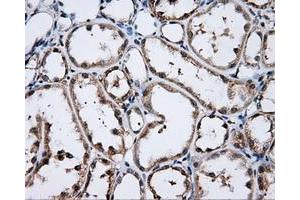 Immunohistochemical staining of paraffin-embedded Kidney tissue using anti-LIPG mouse monoclonal antibody. (LIPG antibody)