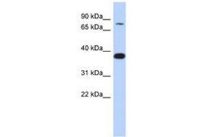 Image no. 1 for anti-Zinc Finger Protein 526 (ZNF526) (AA 179-228) antibody (ABIN6740285) (ZNF526 antibody  (AA 179-228))