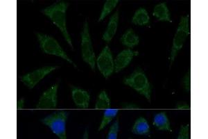 Immunofluorescence analysis of L929 cells using AKR1C2 Polyclonal Antibody at dilution of 1:100 (40x lens). (AKR1C2 antibody)
