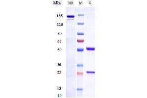 Anti-ETBR Reference Antibody (DEDN6526A) on SDS-PAGE under reducing (R) condition.