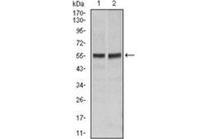 Western Blotting (WB) image for anti-TNF Receptor Superfamily, Member 6 (FAS) antibody (ABIN1106616) (FAS antibody)