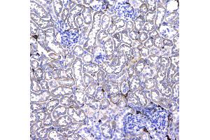 IHC analysis of CD44 using anti-CD44 antibody . (CD44 antibody  (AA 21-259))