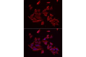 Immunofluorescence analysis of MCF-7 cell using RARRES2 antibody. (Chemerin antibody)