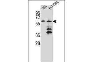 PREF12 Antibody (Center) (ABIN656063 and ABIN2845415) western blot analysis in 293,NCI- cell line lysates (35 μg/lane). (PRAMEF12 antibody  (AA 107-135))