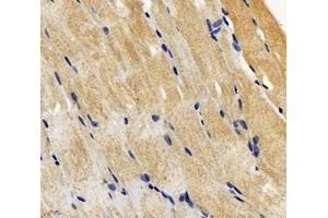 Immunohistochemistry analysis of paraffin-embedded mouse skeletal muscle using SGCA (ABIN7075509) at dilution of 1: 600