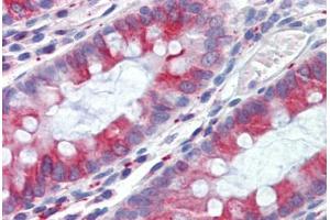 Human Colon (formalin-fixed, paraffin-embedded) stained with TUBB antibody ABIN462130 followed by biotinylated anti-mouse IgG secondary antibody ABIN481714, alkaline phosphatase-streptavidin and chromogen. (TUBB antibody)