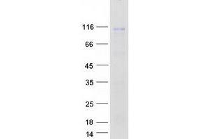 Junctophilin 2 (JPH2) (Transcript Variant 1) protein (Myc-DYKDDDDK Tag)