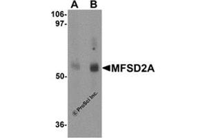 Western blot analysis of MFSD2A in rat lung tissue lysate with MFSD2A antibody at (A) 1 and (B) 2 μg/ml. (MFSD2A antibody  (C-Term))